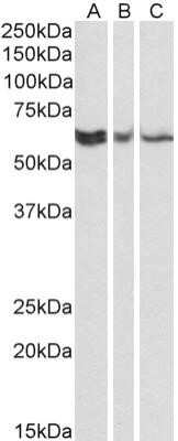 Western Blot: TERF2IP Antibody (78B356.1) - Azide and BSA Free [NBP2-80974] - Western blot analysis of A431 (A), HEK293 (B) and HeLa (C) lysates (35ug per lane, RIPA buffer) using TERF21P antibody (NB100-56526) at 0.1ug/ml. Band observed at ~60kDa. Image from the standard format of this antibody.