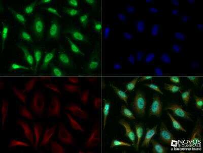 Immunocytochemistry/Immunofluorescence: TERF2IP Antibody [NB100-56321] - HeLa cells were fixed for 10 minutes using 10% formalin and then permeabilized for 5 minutes using 1X TBS + 0.5% Triton-X100. The cells were incubated with anti-TERF2IP [NB100-56321] at a 1:200 dilution overnight at 4C and detected with an anti-rabbit Dylight 488 (Green) at a 1:500 dilution. Alpha tubulin (DM1A; Cat# NB100-690) was used as a co-stain at a 1:1000 dilution and detected with an anti-mouse Dylight 550 (Red) at a 1:500 dilution. Nuclei were counterstained with DAPI (Blue). Cells were imaged using a 40X objective.