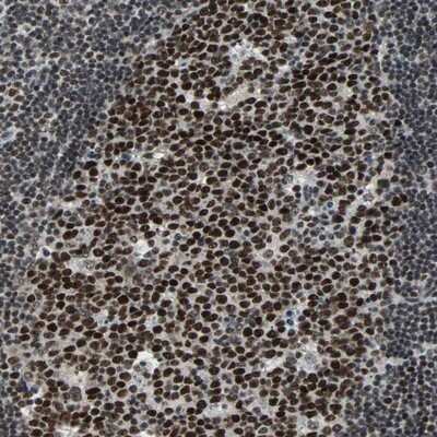 Immunohistochemistry-Paraffin: TERF2IP Antibody [NBP1-82433] - Immunohistochemical staining of human lymph node shows strong nuclear positivity in reaction center cells.