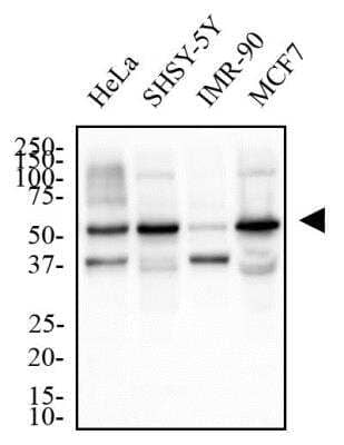 Western Blot: TERF2IP Antibody [NB100-56321] - Total protein from HeLa, SHSH-5Y, IMR-90 and MCF7 cells were separated on a 12% gel by SDS-PAGE, transferred to PVDF membrane and blocked in 5% non-fat milk in TBST. The membrane was probed with 2.0 ug/ml anti-TERF2IP in 1% non-fat milk in TBST and detected with an anti-rabbit HRP secondary antibody using chemiluminescence.