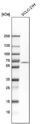 Western Blot: TERF2IP Antibody [NBP1-82433] - Analysis in human cell line SCLC-21H.