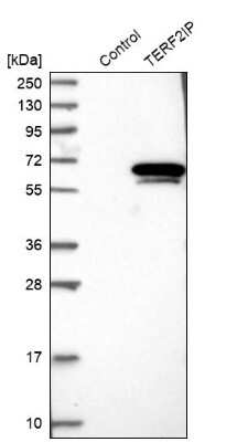 Western Blot: TERF2IP Antibody [NBP1-82433] - Analysis in control (vector only transfected HEK293T lysate) and TERF2IP over-expression lysate (Co-expressed with a C-terminal myc-DDK tag (3.1 kDa) in mammalian HEK293T cells).