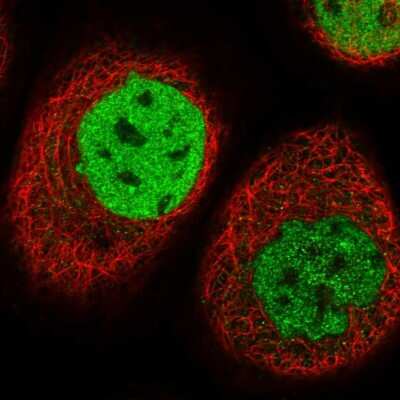 Immunocytochemistry/Immunofluorescence: TESK2 Antibody [NBP1-89442] - Immunofluorescent staining of human cell line A-431 shows localization to nucleoplasm.