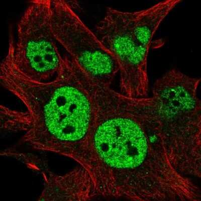 Immunocytochemistry/Immunofluorescence: TESK2 Antibody [NBP2-57017] - Staining of human cell line SK-MEL-30 shows localization to nucleoplasm.