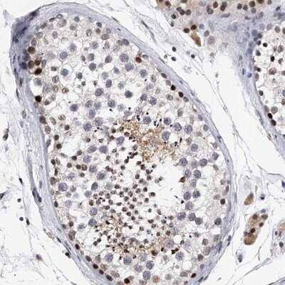 Immunohistochemistry-Paraffin: TESK2 Antibody [NBP1-89442] - Staining of human testis shows moderate positivity in subsets of cells in seminiferus ducts.