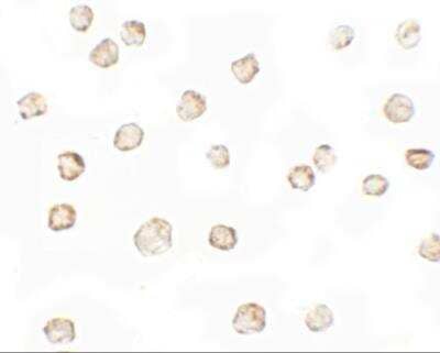 Immunocytochemistry/Immunofluorescence: TESPA1 Antibody [NBP2-81842] - Immunocytochemistry of TESPA1 in A431 cells with TESPA1 antibody at 5 ug/mL.