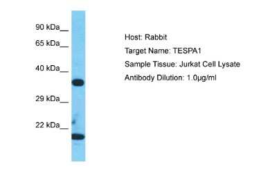 Western Blot: TESPA1 Antibody [NBP2-83642] - Host: Rabbit. Target Name: TESPA1. Sample Type: Jurkat Whole Cell lysates. Antibody Dilution: 1.0ug/ml