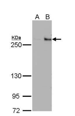 Western Blot: TET1 Antibody (1462) [NBP2-15135] - A. 30 ug 293T whole cell lysate/extract B. 30 ug whole cell lysate/extract of DDDDK-human TET1-transfected 293T cells 5 % SDS-PAGE TET1 antibody dilution: 1:500