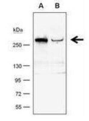 <b>Genetic Strategies Validation. </b>Western Blot: TET1 Antibody (GT1462) [NBP2-15135] - A. 50 ug whole cell lysate/extract from 293T cells transfected with scramble siRNA . B. 50 ug whole cell lysate/extract from TET1-knockdowned 293T cells.