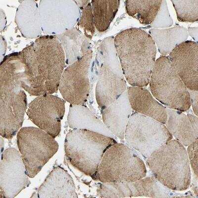 Immunohistochemistry: TET1 Antibody [NBP1-88972] - Staining of human skeletal muscle shows moderate cytoplasmic positivity in myocytes.