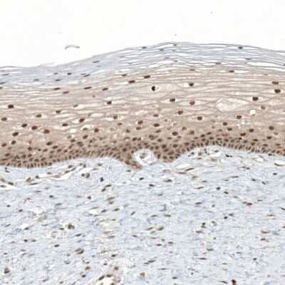 Immunohistochemistry-Paraffin: TET1 Antibody [NBP1-88972] - Staining of human cervix, uterine shows moderate nuclear positivity in squamous epithelial cells.