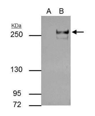 Immunoprecipitation: TET2 Antibody (411) [NBP2-43682] - Analysis of 30 ug whole cell extract of TET2-transfected 293T cells. A. Control with 5 ug of preimmune Rabbit IgG B. Immunoprecipitation of TET2 protein by 5 ug TET2 antibody [411] 5 % SDS-PAGE The immunoprecipitated TET2 protein was detected by TET2 antibody [411] diluted at 1:500. [EasyBlot anti-rabbit IgG was used as a secondary reagent] .