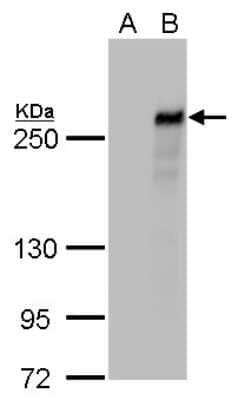 Western Blot: TET2 Antibody (411) [NBP2-43682] - Analysis of A. 30 ug 293T whole cell lysate/extract B. 30 ug whole cell lysate/extract of DDDDK-human TET2-transfected 293T cells 5 % SDS-PAGE TET2 antibody [411] dilution: 1:1000