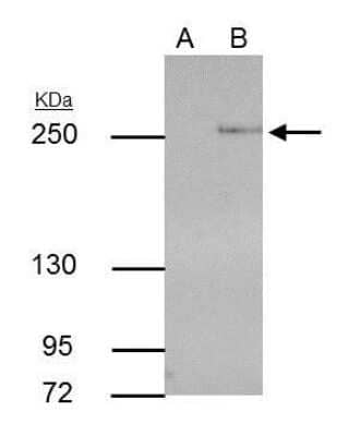 Immunoprecipitation: TET2 Antibody (442) [NBP2-43579] - Analysis of 30 ug whole cell extract of TET2-transfected 293T cells. A. Control with 5 ug of preimmune Rabbit IgG B. Immunoprecipitation of TET2 protein by 5 ug TET2 antibody [422] 5 % SDS-PAGE The immunoprecipitated TET2 protein was detected by TET2 antibody [422] diluted at 1:500. [EasyBlot anti-rabbit IgG was used as a secondary reagent] .