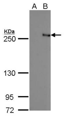 Western Blot: TET2 Antibody (442) [NBP2-43579] - Analysis of A. 30 ug 293T whole cell lysate/extract B. 30 ug whole cell lysate/extract of DDDDK-human TET2-transfected 293T cells 5 % SDS-PAGE TET2 antibody [442] dilution: 1:5000