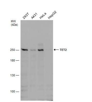 Western Blot TET2 Antibody (649)