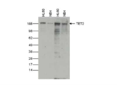 Western Blot: TET2 Antibody (C.15200179) [NBP2-59256] - Whole cell extracts from HL60 and NB4 cells (40 ug) were analysed by Western blot using the Diagenode antibody against TET2, diluted 1:2,000 (lane 1 and 2) or 1:1,000 (lane 3 and 4) in PBS containing 10% milk.  The position of the protein of interest (expected MW 224 kDa) is indicated on the right; the marker (kDa) is shown on the left.