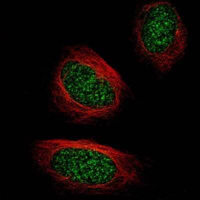 Immunocytochemistry/Immunofluorescence: TET2 Antibody (CL6873) [NBP2-76510] - Staining of U-2 OS cells using the Anti-TET2 monoclonal antibody, showing specific staining in the nucleus in green. Microtubule- and nuclear probes are visualized in red and blue, respectively (where available).