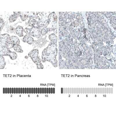 Immunohistochemistry-Paraffin TET2 Antibody (CL6873)