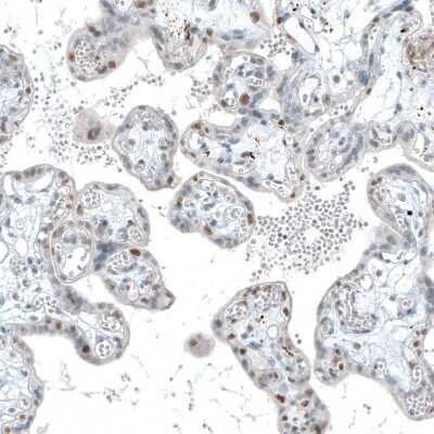 Immunohistochemistry-Paraffin: TET2 Antibody (CL6873) [NBP2-76510] - Staining of human placenta shows moderate nuclear positivity in a subset of trophoblastic cells.