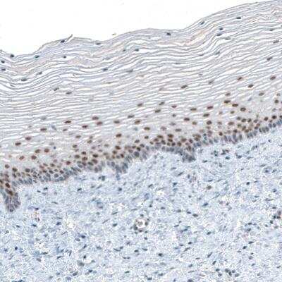 Immunohistochemistry-Paraffin: TET2 Antibody (CL6873) [NBP2-76510] - Staining of human uterine cervix shows moderate nuclear positivity in squamous epithelial cells.