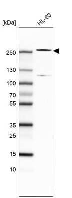 <b>Orthogonal Strategies Validation. </b>Western Blot: TET2 Antibody (CL6873) [NBP2-76510] - Analysis in human cell line HL-60.