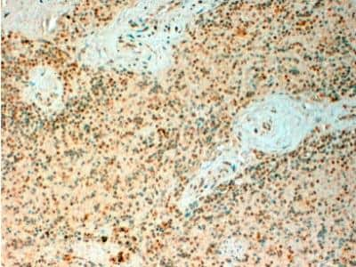 Immunohistochemistry-Paraffin: TET2 Antibody [NBP2-27465] - Staining of paraffin embedded Human Spleen. Antibody at 4 ug/mL. Steamed antigen retrieval with citrate buffer pH 6, HRP-staining.