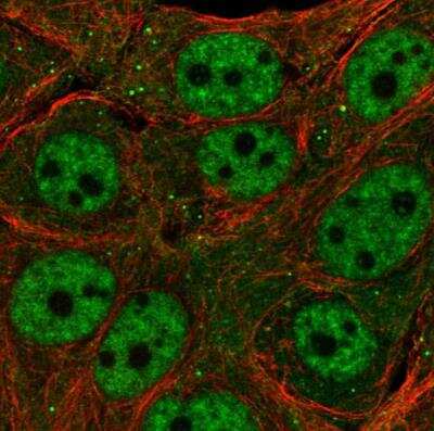 Immunocytochemistry/ Immunofluorescence TET3 Antibody