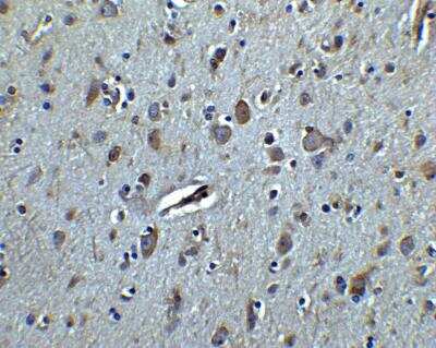 Immunohistochemistry: TET3 Antibody [NBP2-82066] - Immunohistochemistry of TET3 in human brain tissue with TET3 antibody at 2.5 ug/ml. 