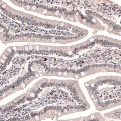 Immunohistochemistry-Paraffin: TET3 Antibody [NBP2-13427] - Staining of human duodenum shows weak nuclear positivity in a subset of glandular cells.