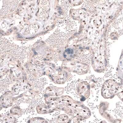 Immunohistochemistry-Paraffin: TET3 Antibody [NBP2-13427] - Staining of human placenta shows moderate nuclear positivity in a subset of cells in chorionic villi.