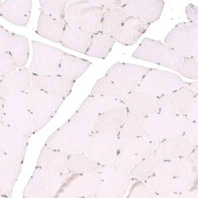 Immunohistochemistry-Paraffin: TET3 Antibody [NBP2-13427] - Staining of human skeletal muscle shows no positivity in striated muscle fibers as expected.