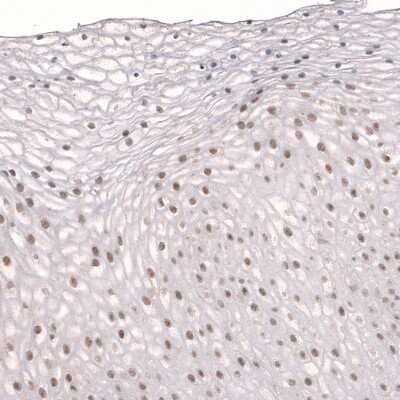 Immunohistochemistry-Paraffin: TET3 Antibody [NBP2-13427] - Staining of human uterine cervix shows moderate nuclear positivity in squamous epithelial cells.