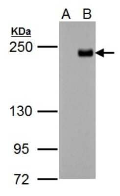 Western Blot: TET3 Antibody [NBP2-20603] - A. 30 ug 293T whole cell lysate/extractB. 30 ug whole cell lysate/extract of Flag-human TET3-transfected 293T cells5 % SDS-PAGE TET3 antibody [N3C1], Internal dilution: 1:5000.