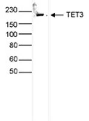 Western Blot: TET3 Antibody [NBP3-18691] - Figure 2. Western blot analysis using the antibody directed against TET3 Whole cell extracts (25 ug) from Jurkat cells were analysed by Western blot using the antibody against TET3 diluted 1:1,000 in TBS-Tween containing 5% skimmed milk. The position of the protein of interest is indicated on the right; the marker (in kDa) is shown on the left.