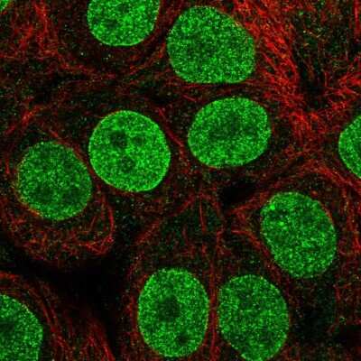 Immunocytochemistry/ Immunofluorescence TETRAN Antibody