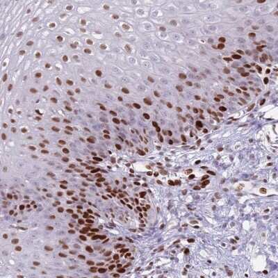 Immunohistochemistry TETRAN Antibody