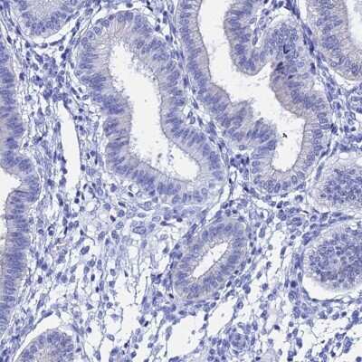Immunohistochemistry-Paraffin: TEX101 Antibody [NBP1-84356] - Staining of human endometrium shows low expression as expected.
