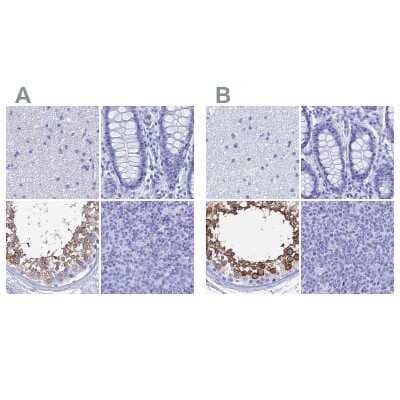 <b>Independent Antibodies Validation. </b>Immunohistochemistry-Paraffin: TEX101 Antibody [NBP1-84356] - Staining of human cerebral cortex, colon, testis and tonsil using Anti-TEX101 antibody NBP1-84356 (A) shows similar protein distribution across tissues to independent antibody NBP1-84357 (B).
