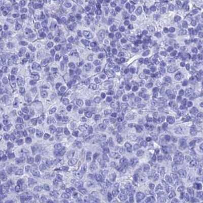 Immunohistochemistry-Paraffin: TEX101 Antibody [NBP1-84356] - Staining of human tonsil.