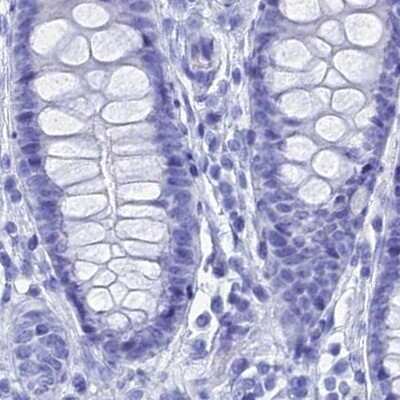 Immunohistochemistry-Paraffin: TEX101 Antibody [NBP1-84356] - Staining of human colon.