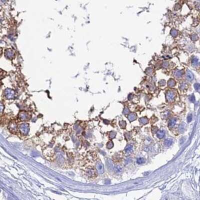 Immunohistochemistry-Paraffin TEX101 Antibody - BSA Free