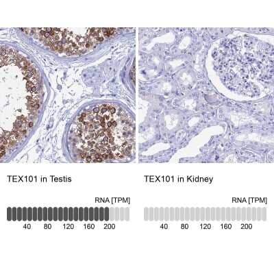 <b>Orthogonal Strategies Validation. </b>Immunohistochemistry-Paraffin: TEX101 Antibody [NBP1-84357] - Staining in human testis and kidney tissues using anti-TEX101 antibody. Corresponding TEX101 RNA-seq data are presented for the same tissues.