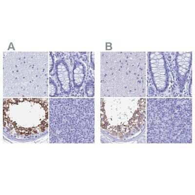 <b>Independent Antibodies Validation. </b>Immunohistochemistry-Paraffin: TEX101 Antibody [NBP1-84357] - Staining of human cerebral cortex, colon, testis and tonsil using Anti-TEX101 antibody NBP1-84357 (A) shows similar protein distribution across tissues to independent antibody NBP1-84356 (B).