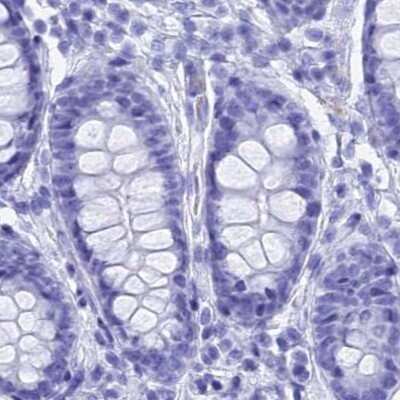 Immunohistochemistry-Paraffin: TEX101 Antibody [NBP1-84357] - Staining of human colon.