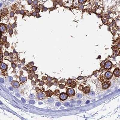 Immunohistochemistry-Paraffin TEX101 Antibody - BSA Free