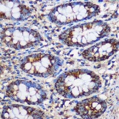 Immunohistochemistry-Paraffin: TEX101 Antibody [NBP2-94471] - Immunohistochemistry of paraffin-embedded Human colon using TEX101 antibody at dilution of 1:100 (40x lens).