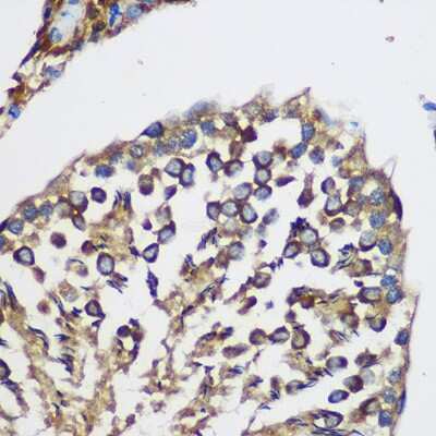 Immunohistochemistry-Paraffin: TEX101 Antibody [NBP2-94471] - Immunohistochemistry of paraffin-embedded Rat testis using TEX101 Rabbit pAb (NBP2-94471) at dilution of 1:100 (40x lens). Perform microwave antigen retrieval with 10 mM PBS buffer pH 7.2 before commencing with IHC staining protocol.