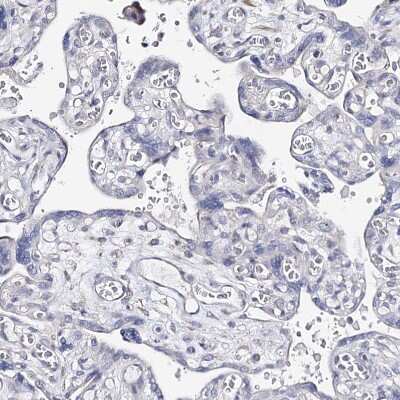 Immunohistochemistry-Paraffin: TEX12 Antibody [NBP1-90989] - Staining of human placenta shows no positivity in trophoblastic cells as expected.