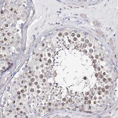 Immunohistochemistry-Paraffin: TEX12 Antibody [NBP1-90989] - Staining of human testis shows nuclear positivity in spermatids.